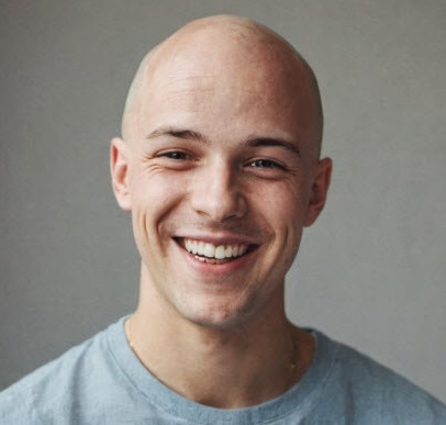 no more baldness at www.bald2hair.com